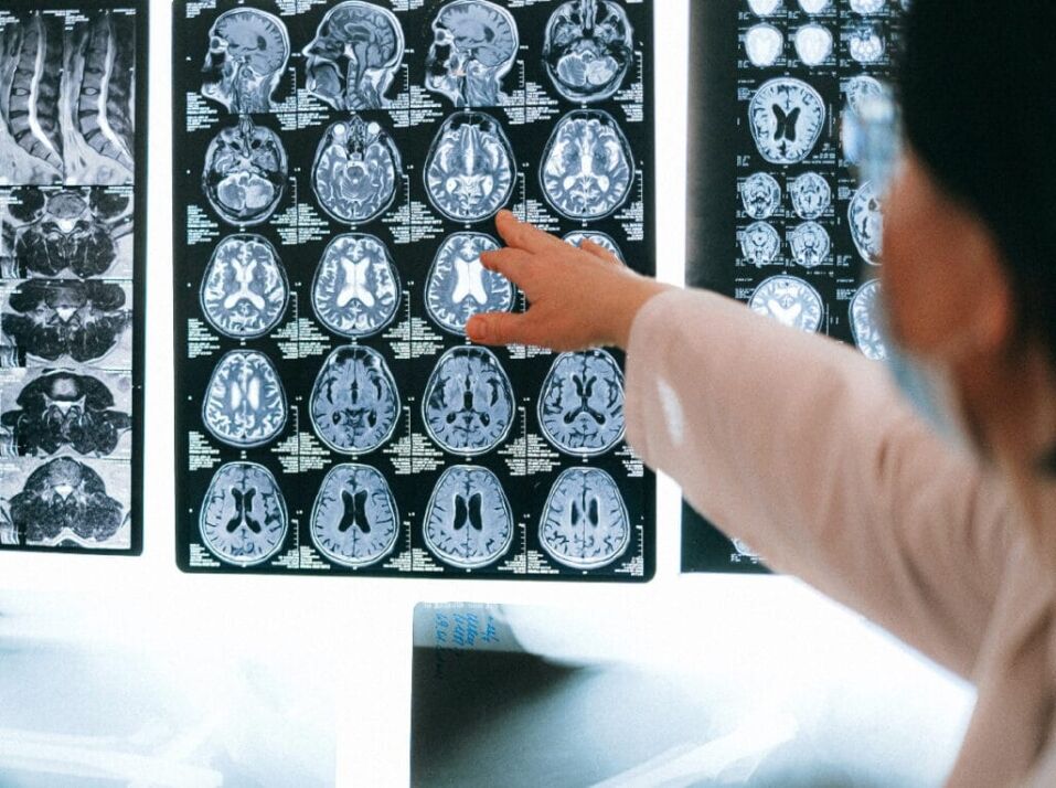 doctor looking at a brain scan
